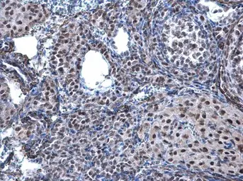 Anti-CBX1 / HP1 beta antibody used in IHC (Paraffin sections) (IHC-P). GTX106418