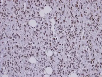 Anti-SAP130 antibody [C3], C-term used in IHC (Paraffin sections) (IHC-P). GTX106450