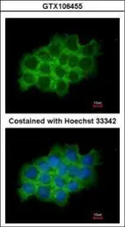 Anti-SEC61A1 antibody used in Immunocytochemistry/ Immunofluorescence (ICC/IF). GTX106455