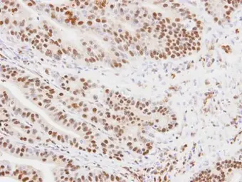 Anti-MKRN1 antibody [N2N3] used in IHC (Paraffin sections) (IHC-P). GTX106459