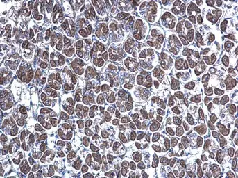 Anti-GGA3 antibody [C3], C-term used in IHC (Paraffin sections) (IHC-P). GTX106461