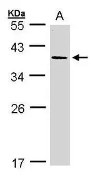 Anti-AKR7A3 antibody [N3C3] used in Western Blot (WB). GTX106613