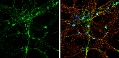 Anti-alpha SNAP antibody [N2C3] used in Immunocytochemistry/ Immunofluorescence (ICC/IF). GTX106626