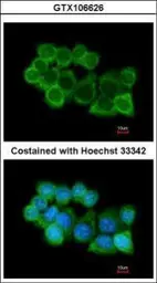 Anti-alpha SNAP antibody [N2C3] used in Immunocytochemistry/ Immunofluorescence (ICC/IF). GTX106626