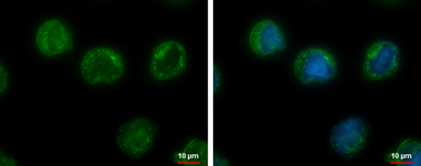 Anti-CHMP5 antibody [N1C3] used in Immunocytochemistry/ Immunofluorescence (ICC/IF). GTX106692