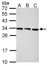 Anti-PSME3 antibody used in Western Blot (WB). GTX106722