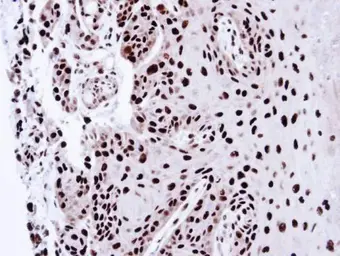 Anti-PSME3 antibody used in IHC (Paraffin sections) (IHC-P). GTX106722