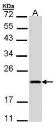 Anti-Diablo antibody [N1C3] used in Western Blot (WB). GTX106746