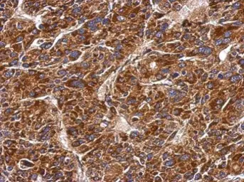 Anti-MMAB antibody used in IHC (Paraffin sections) (IHC-P). GTX106767