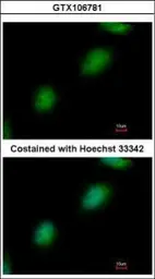 Anti-TPRKB antibody used in Immunocytochemistry/ Immunofluorescence (ICC/IF). GTX106781