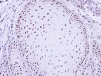 Anti-PRP19 antibody [C1C3] used in IHC (Paraffin sections) (IHC-P). GTX106952