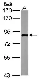 Anti-ZER1 antibody [C2C3], C-term used in Western Blot (WB). GTX106983