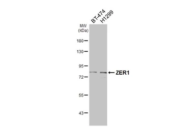 Anti-ZER1 antibody [C2C3], C-term used in Western Blot (WB). GTX106983