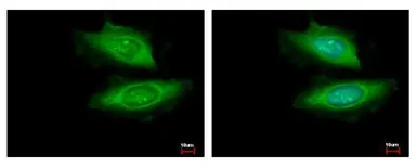 Anti-VCPIP1 antibody [C2C3], C-term used in Immunocytochemistry/ Immunofluorescence (ICC/IF). GTX107169