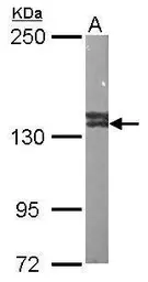 Anti-VCPIP1 antibody [C2C3], C-term used in Western Blot (WB). GTX107169