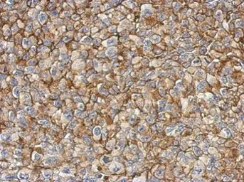 Anti-FAM83B antibody [N1N2], N-term used in IHC (Paraffin sections) (IHC-P). GTX107222