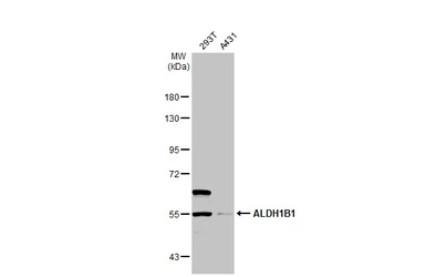 Anti-ALDH1B1 antibody used in Western Blot (WB). GTX107279