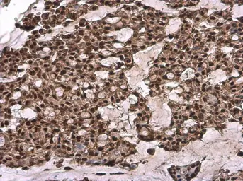 Anti-TFIIB antibody [N1C3] used in IHC (Paraffin sections) (IHC-P). GTX107327