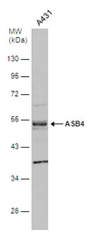 Anti-ASB4 antibody [N1C3] used in Western Blot (WB). GTX107345