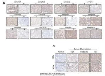 Anti-Acylglycerol kinase antibody used in IHC (Paraffin sections) (IHC-P). GTX107413