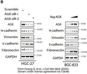 Anti-Acylglycerol kinase antibody used in Western Blot (WB). GTX107413