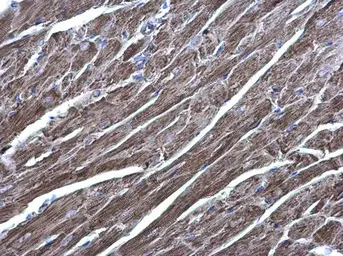 Anti-Acylglycerol kinase antibody used in IHC (Paraffin sections) (IHC-P). GTX107413