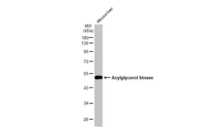 Anti-Acylglycerol kinase antibody used in Western Blot (WB). GTX107413