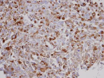 Anti-Acylglycerol kinase antibody used in IHC (Paraffin sections) (IHC-P). GTX107413