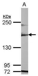 Anti-MAST1 antibody [N2N3] used in Western Blot (WB). GTX107508
