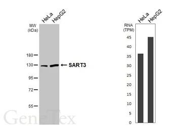 Anti-SART3 antibody [C3], C-term used in Western Blot (WB). GTX107684