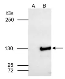 Anti-SART3 antibody [C3], C-term used in Immunoprecipitation (IP). GTX107684