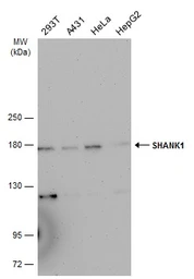 Anti-SHANK1 antibody [C3], C-term used in Western Blot (WB). GTX107701