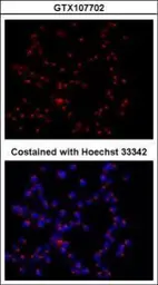 Anti-GOLPH2 antibody [C3], C-term used in Immunocytochemistry/ Immunofluorescence (ICC/IF). GTX107702