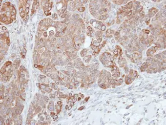 Anti-HPS3 antibody [C3], C-term used in IHC (Paraffin sections) (IHC-P). GTX107745