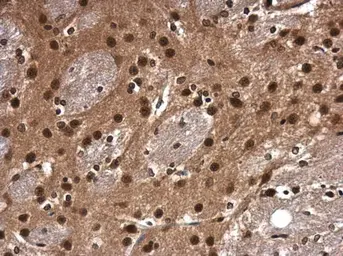 Anti-CDK9 antibody [N3C3] used in IHC (Paraffin sections) (IHC-P). GTX107758