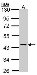 Anti-MVK antibody [N3C3] used in Western Blot (WB). GTX107761