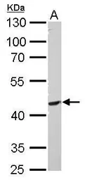 Anti-PI3 kinase p55 gamma antibody used in Western Blot (WB). GTX107779