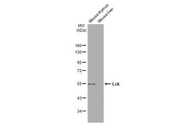 Anti-Lck antibody [N3C3] used in Western Blot (WB). GTX107785