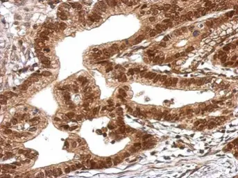 Anti-TRIM27 antibody used in IHC (Paraffin sections) (IHC-P). GTX107805