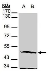 Anti-PGK2 antibody [N3C3] used in Western Blot (WB). GTX107837