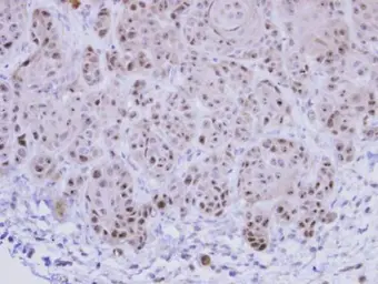 Anti-EXOSC10 antibody used in IHC (Paraffin sections) (IHC-P). GTX107856