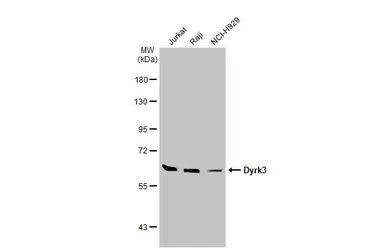 Anti-Dyrk3 antibody used in Western Blot (WB). GTX107889