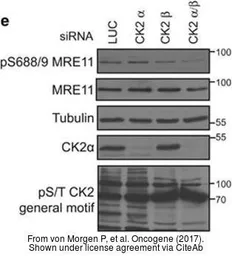 Anti-Casein Kinase 2 alpha antibody used in Western Blot (WB). GTX107897