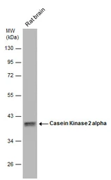 Anti-Casein Kinase 2 alpha antibody used in Western Blot (WB). GTX107897