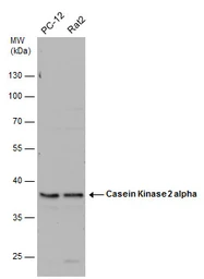 Anti-Casein Kinase 2 alpha antibody used in Western Blot (WB). GTX107897