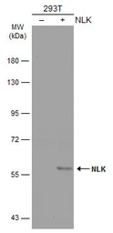 Anti-NLK antibody [N3C3] used in Western Blot (WB). GTX107910