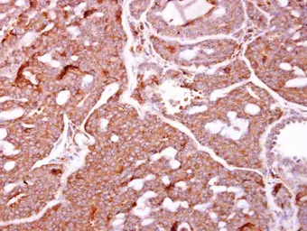 Anti-IKK beta antibody used in IHC (Paraffin sections) (IHC-P). GTX107970
