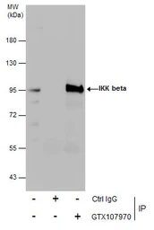 Anti-IKK beta antibody used in Immunoprecipitation (IP). GTX107970