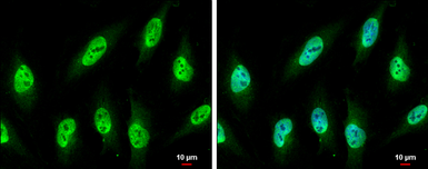 Anti-Nucleoporin p62 antibody used in Immunocytochemistry/ Immunofluorescence (ICC/IF). GTX107973