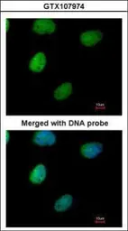 Anti-ITPK1 antibody [N3C3] used in Immunocytochemistry/ Immunofluorescence (ICC/IF). GTX107974
